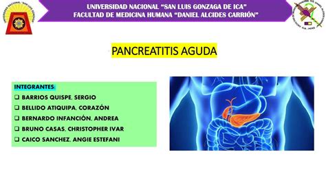 Pancreatitis Aguda Mabel Pariona Chu Occa Udocz