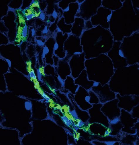 Green Fluorescent Protein Gfp Conducting Cells Containing Nuclei In