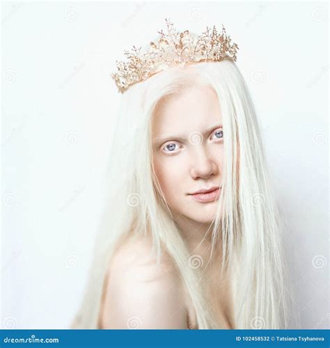 Fille Albinos Avec La Peau Blanche Les Lèvres Naturelles Et Les