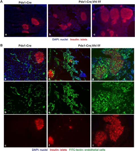 A Immuno Fluorescent Staining Of Representative Pancreas In Pdx1 Cre