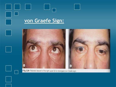 Ppt Differential Diagnosis Of Orbital Disease Powerpoint Presentation