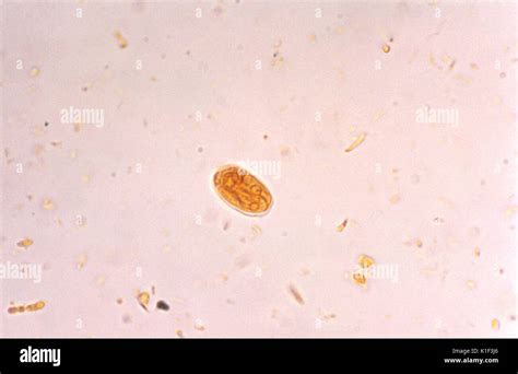 Photomicrograph Of A Giardia Lamblia Cyst Visualized Using An Iodine Stain Giardia Lamblia The