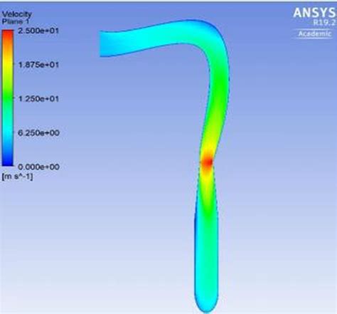 Figure 8 Diameter Increase In The Middle 3D Modeling And Simulation