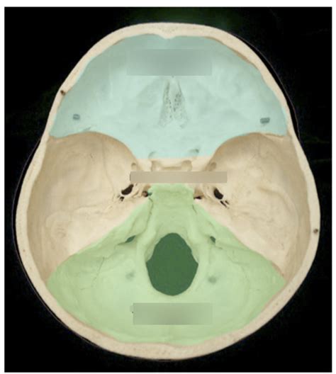 Cranial Fossa Diagram Quizlet