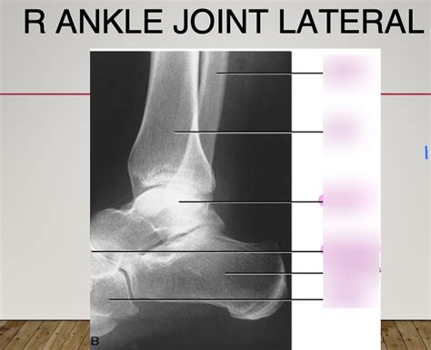 Lateral Ankle Diagram Quizlet