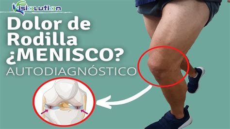 Sobre El Dolor De Rodilla Por Qu Me Duele Y Qu Puedo Hacer