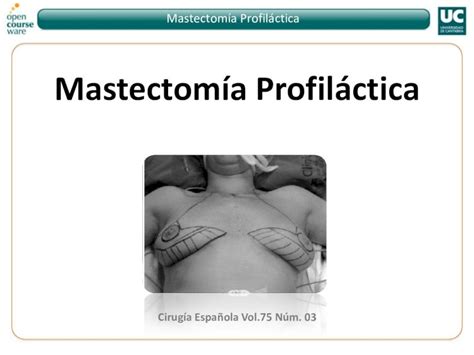 Pdf Mastectom A Profil Ctica Se Pueden Usar Para Determinar El