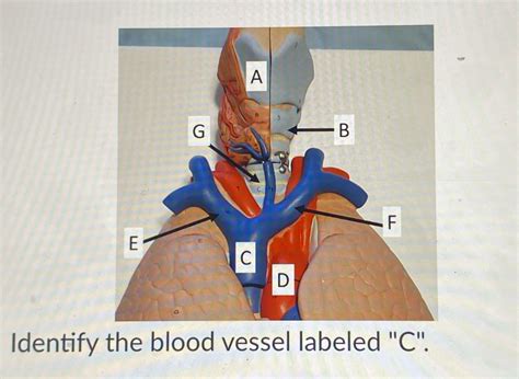 Solved A G B F M C D Identify The Blood Vessel Labeled C Course Hero