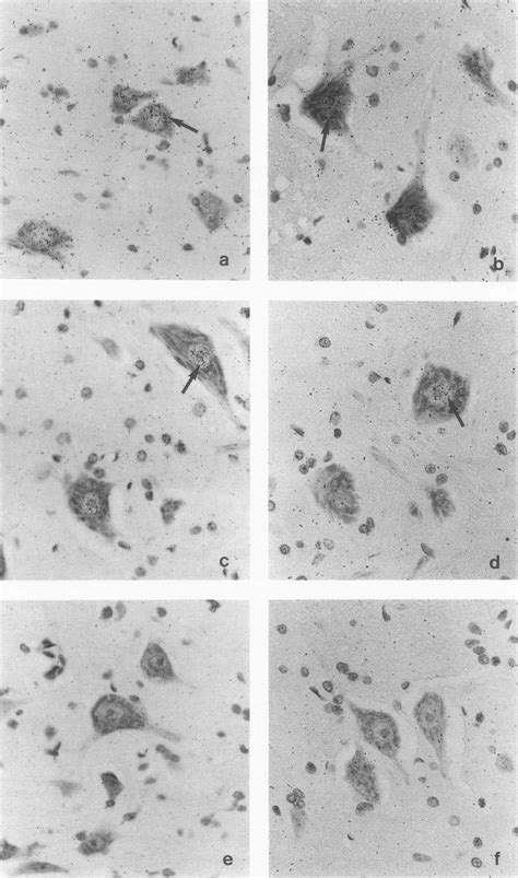 In Situ Hybridization With Slabeled Dna Probes In The Spinal Cord Of