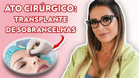 Ato Cir Rgico Transplante De Sobrancelhas Lili Spada Youtube