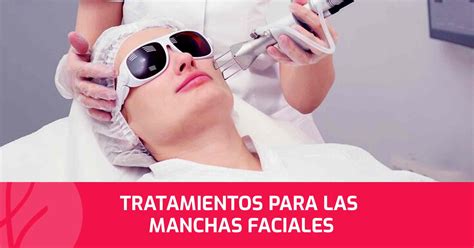 Tratamientos para las Manchas Faciales Dr Edwin Vásquez