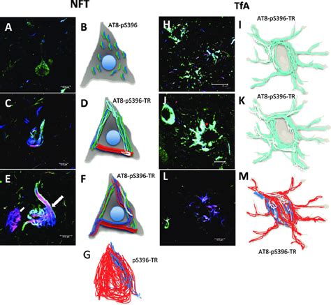 Schematic Representation Of The Tau Aggregation Process In Neuronal And