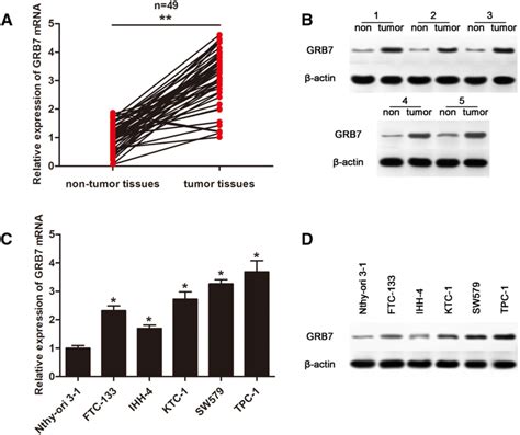 Expression Pattern Of Grb7 In Tc Tissues And Cells A And C The