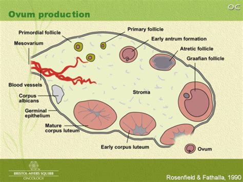 Ovarian Cysts Combined With Benign And Malignant Cysts Flashcards