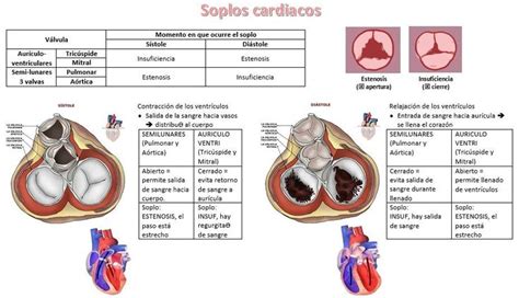 An Image Of The Heart And Its Valves