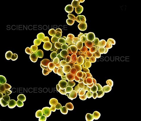 Photograph Staphylococcus Epidermidis SEM Science Source Images