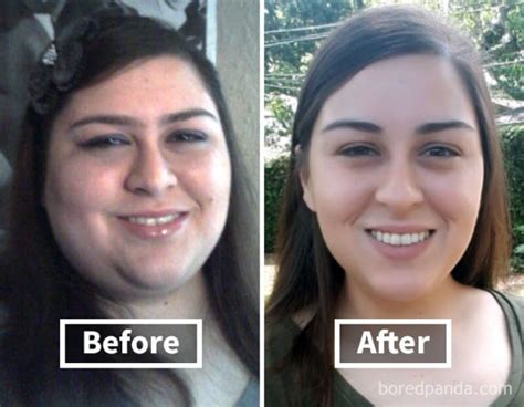 Heres How Weight Loss Can Change Your Face 40 Pics