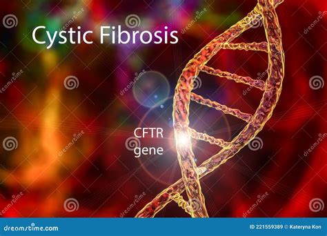 Fibrose Qu Stica Uma Perturba O Gen Tica Causada Por Muta O Na