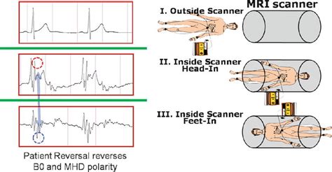 Image-Guided Cardiac Electrophysiology Procedures Focusing on MRI Guidance | Radiology Key