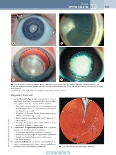 Kanski Oftalmologia Clinica 8a Edicion Booksmedicos Org