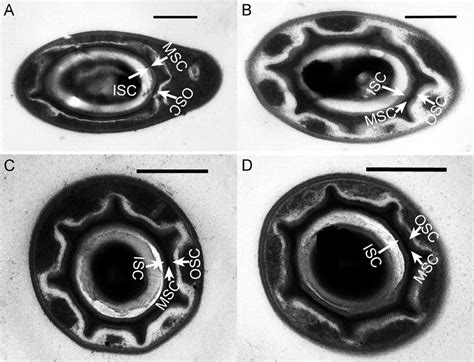 Transmission Electron Micrographs Of Endospores Of Paenibacillus