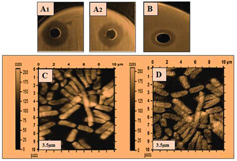 Antibacterial Activity Of Lysozyme Zone Of Inhibition ZOI A B ZOI