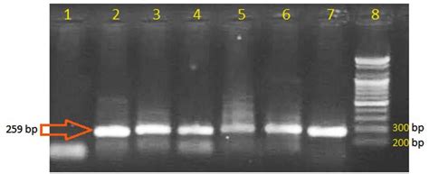 Molecular Detection of Oxa-48 β-lactamase in Proteus spp. causing UTI ...