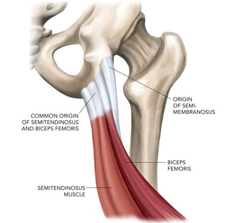 hamstring pain   recover   proximal hamstring injury