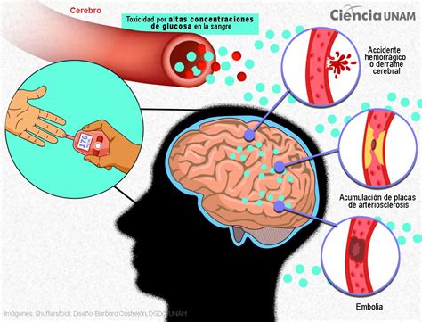 Cómo la diabetes pone en peligro al cerebro Ciencia UNAM