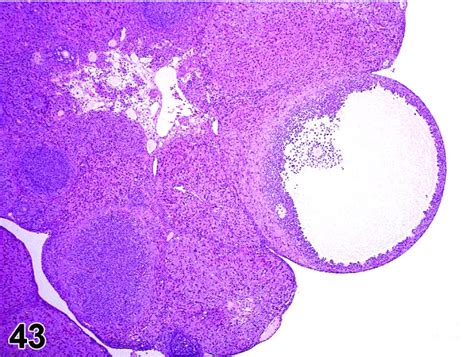 Nonproliferative And Proliferative Lesions Of The Rat And Mouse Female