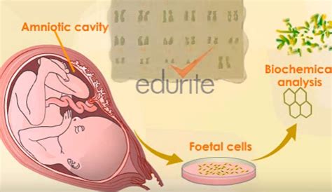 Understanding the Karyotype Blood Test Results | HRFnd