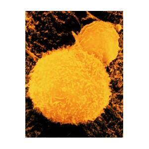 Sem Of T Lymphocyte Killer Cell Photograph By Dr Andrejs Liepins