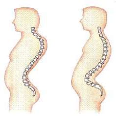 Colpo di frusta cos è e quali sono le conseguenze physiolife velletri