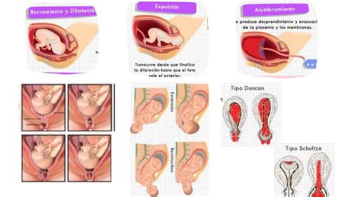 Mecanismos Del Trabajo De Parto Video