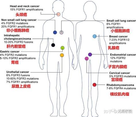 国内首款fgfr抑制剂国内获批，多款靶向药横扫胆管癌、肝癌、胃癌等16大癌种！ 知乎