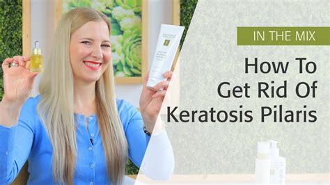 How To Get Rid Of Keratosis Pilaris Eminence Organics Youtube