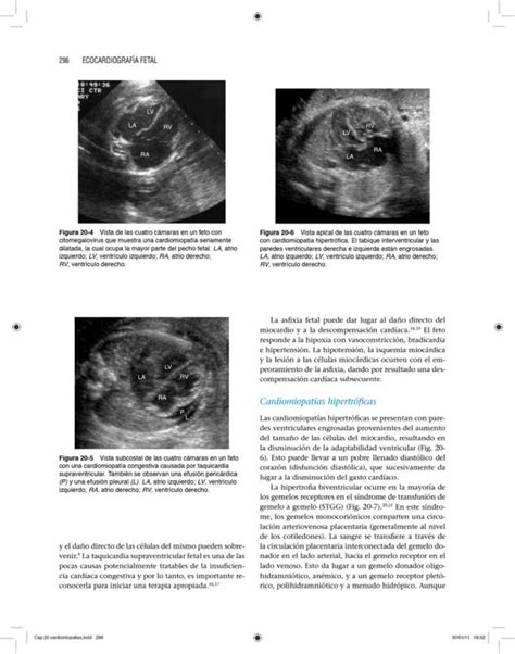 Libro Ecocardiografía Fetal 1era edición en Campus