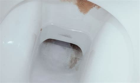 How To Remove Toilet Limescale ‘effortlessly For ‘spotless Results