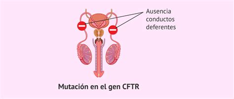 Qué es la fibrosis quística