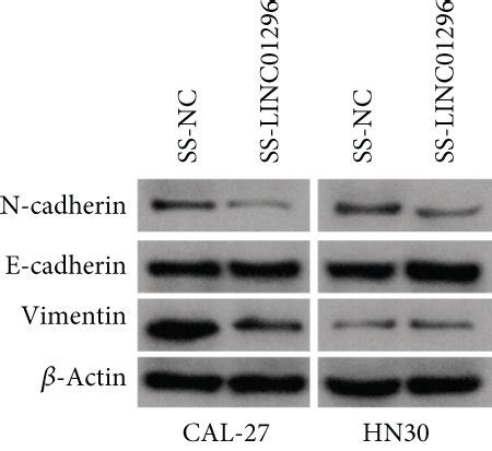 Linc Promotes The Proliferation Migration Invasion And Emt