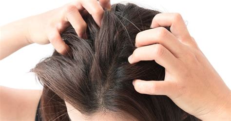 10 Most Common Causes of Scalp Infections - Facty Health