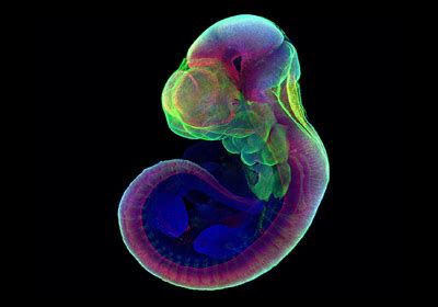 Lab Grown Mouse Embryos Form Limbs And Organs The Scientist Magazine