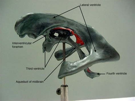 Ventricular System Labeled