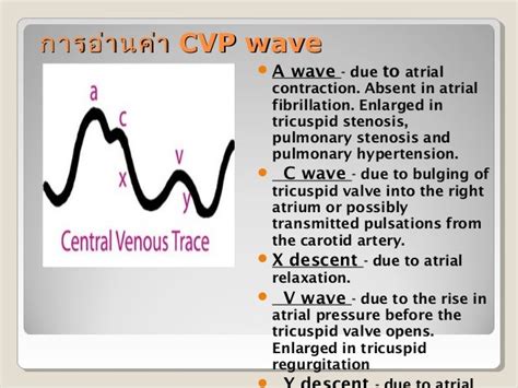 Cvp central venous pressure monitoring