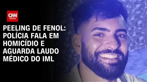 Caso Peeling Polícia Fala Em Homicídio E Aguarda Laudo Médico Do Iml