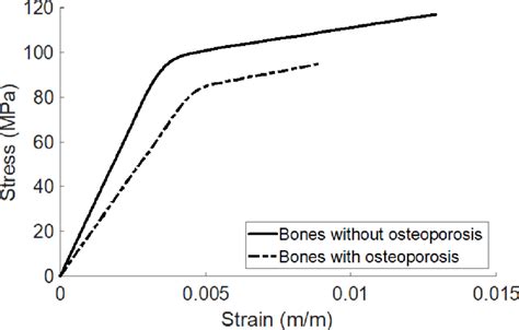 The Stress Strain Curves Of Bones With And Without Osteoporosis This