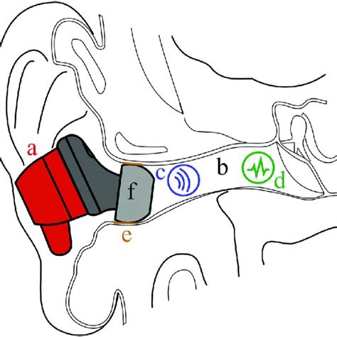 placement   earbud   ear canal  ih earbud  fitted