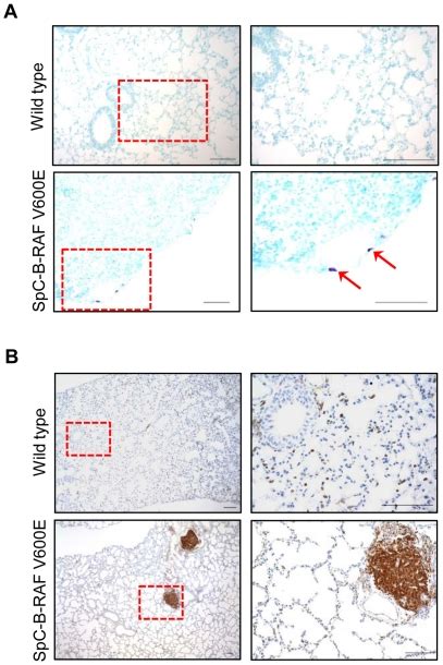 A Toluidine Blue Staining Identifies Mast Cells Purple In The