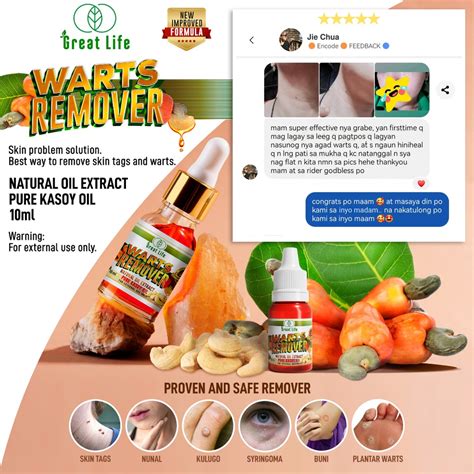 Warts Remover Original Cream Pure Kasoy Oil Pantanggal Ng Warts Nunal