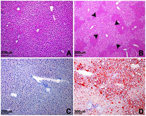 Histopathology Of The Liver Ab Hematoxylin And Eosin Staining Of